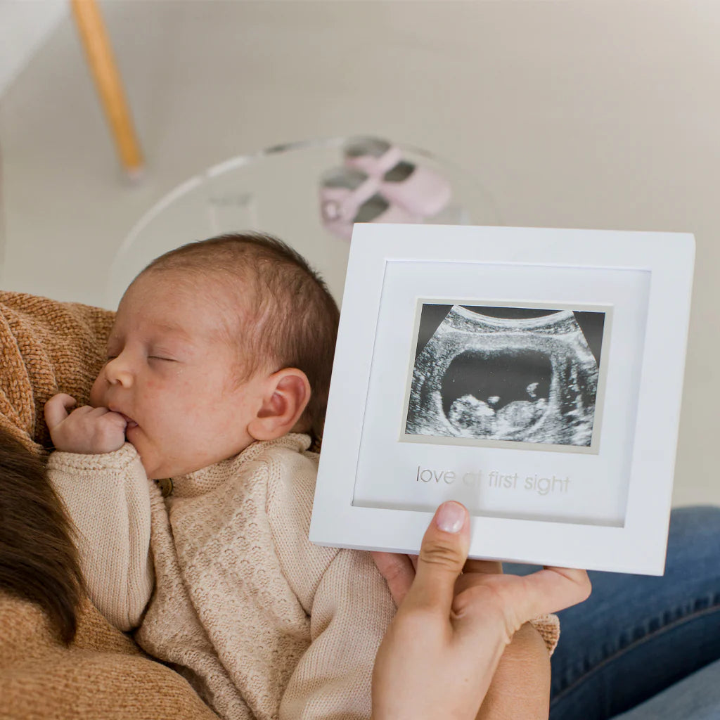 Celebrate your bundle of joy with Pearhead's sonogram frame! Comes with an easel and sawtooth hanger, plus an acid-free beveled mat for your precious 3